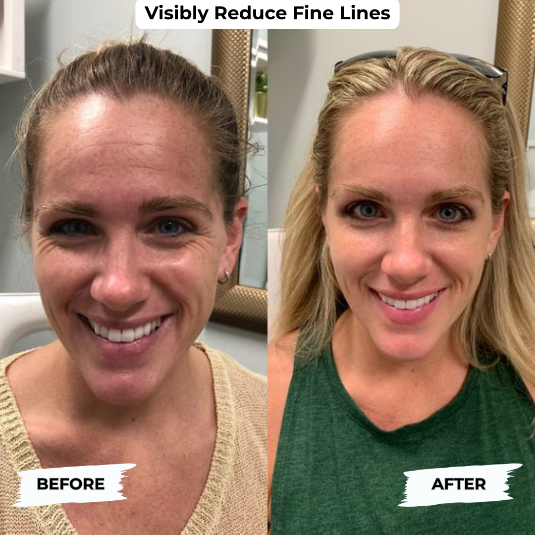 Peptide Complete Anti-Aging System