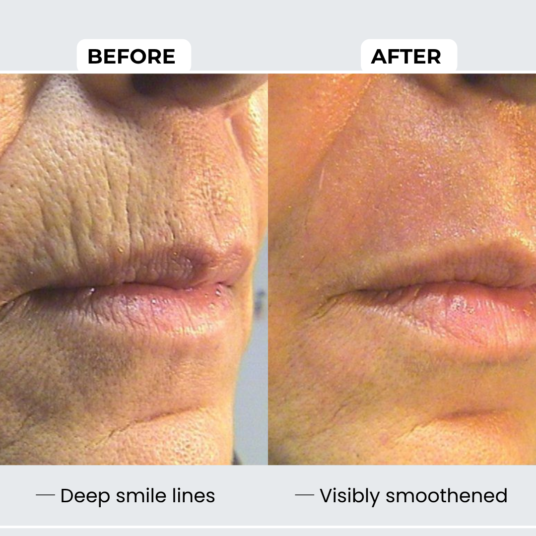 Peptide Complete Anti-Aging System