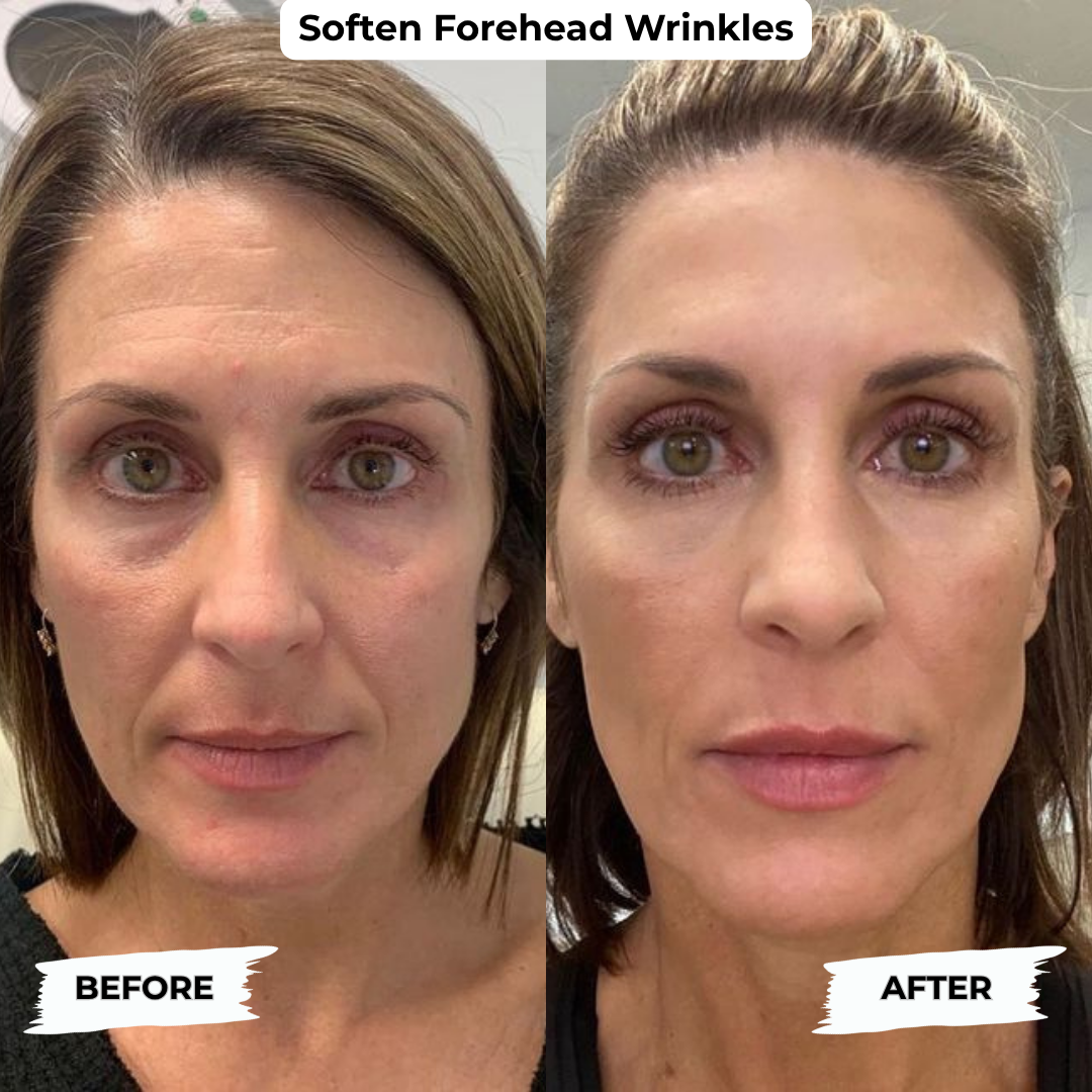 Peptide Complete Anti-Aging System